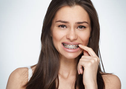 switch-to-invisalign