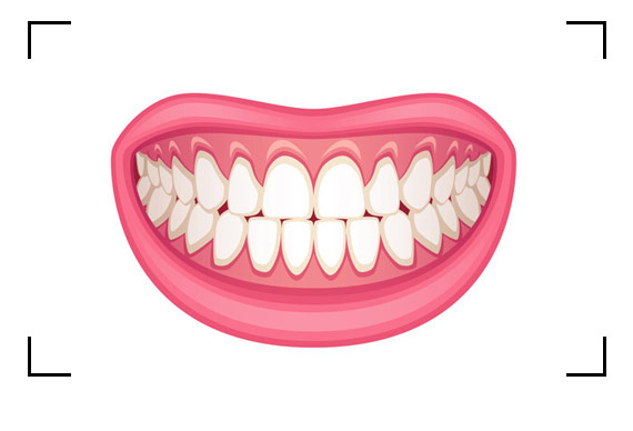 Photo 3 - Front teeth