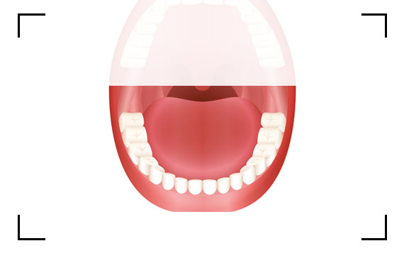 Photo 2 - Lower teeth