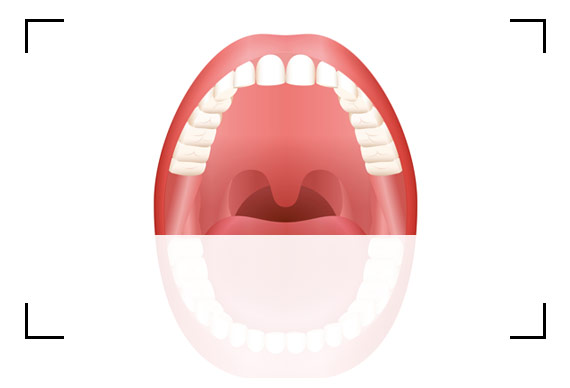 Photo 1 - Upper teeth