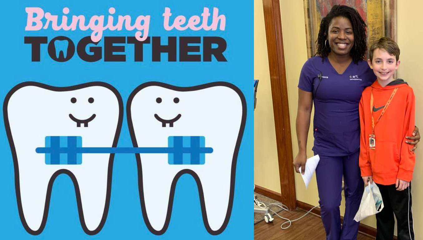 bringing teeth together