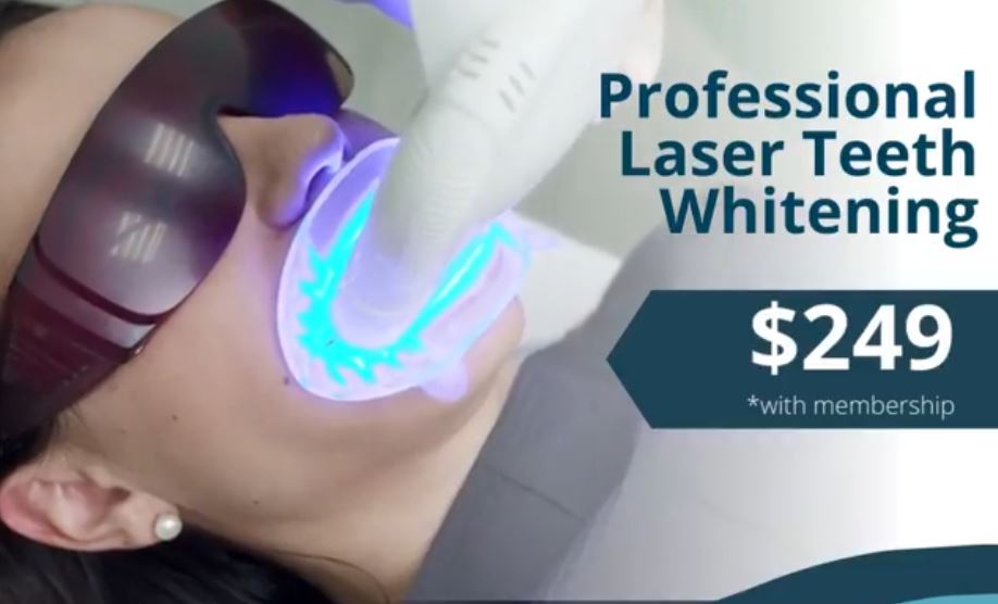 Professional Laser Teeth Whitening