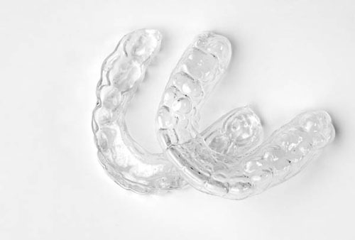 clear retainers