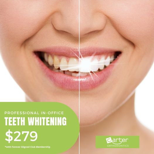 Brighter Smile in No Time