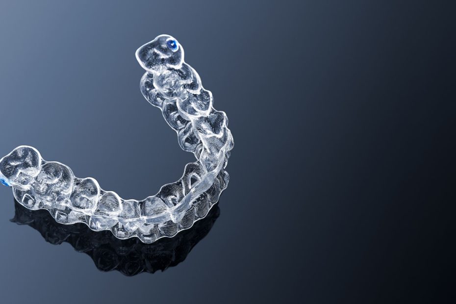 clear aligners