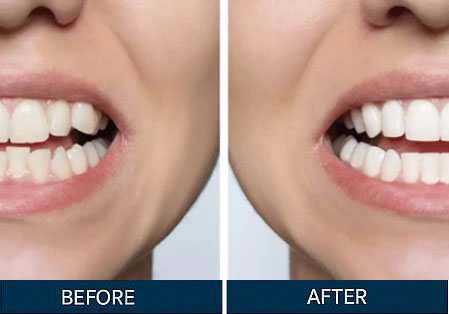 Before & After