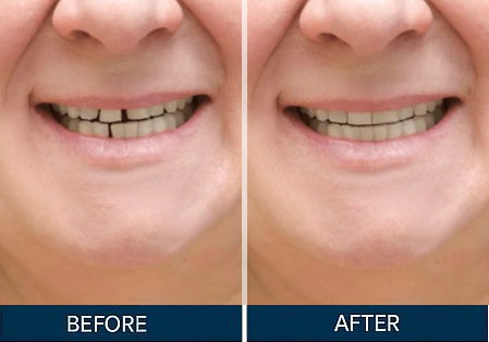 Before & After