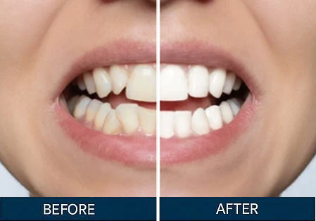 Before & After