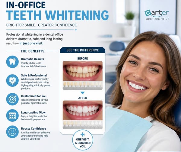 Professional in office whitening